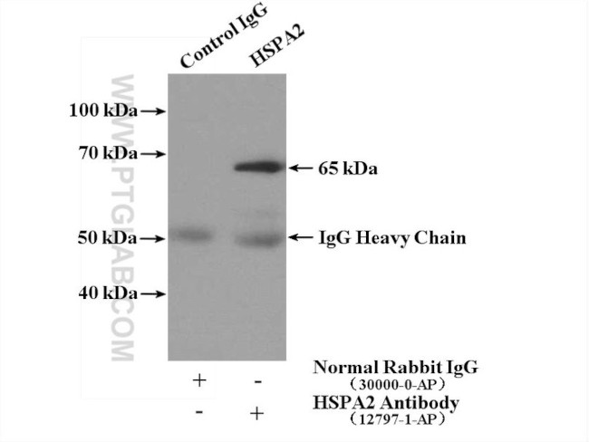 HSPA2 Antibody in Immunoprecipitation (IP)