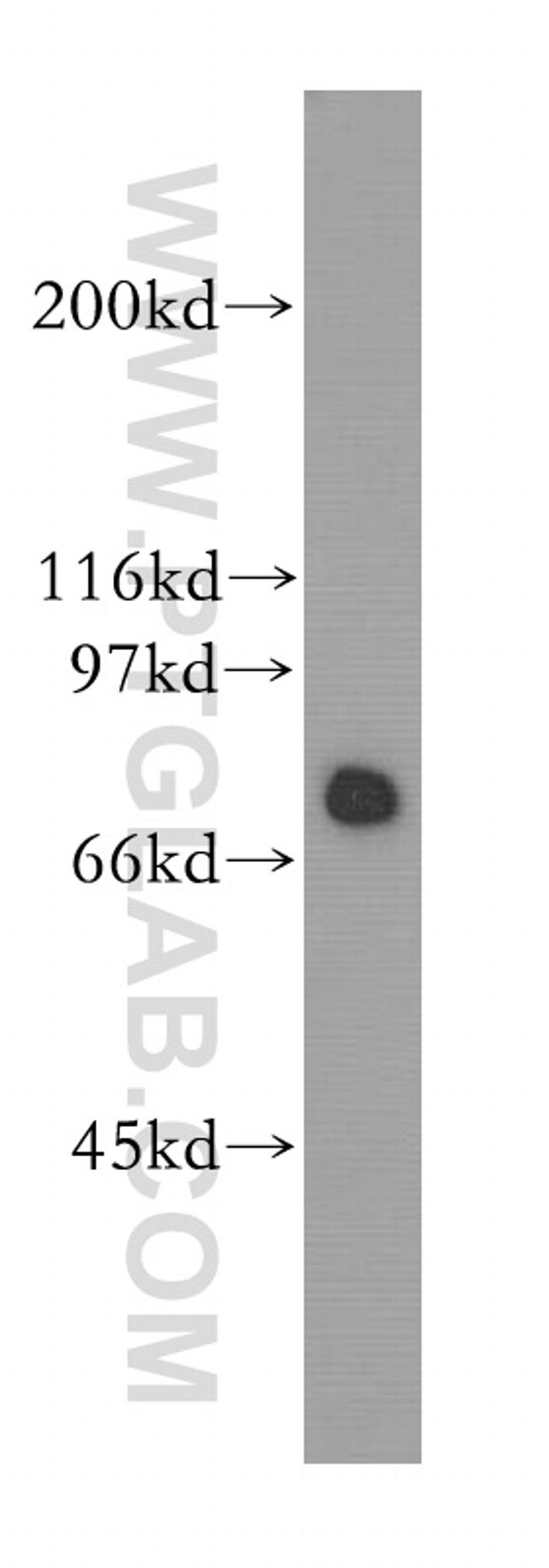 HSPA2 Antibody in Western Blot (WB)