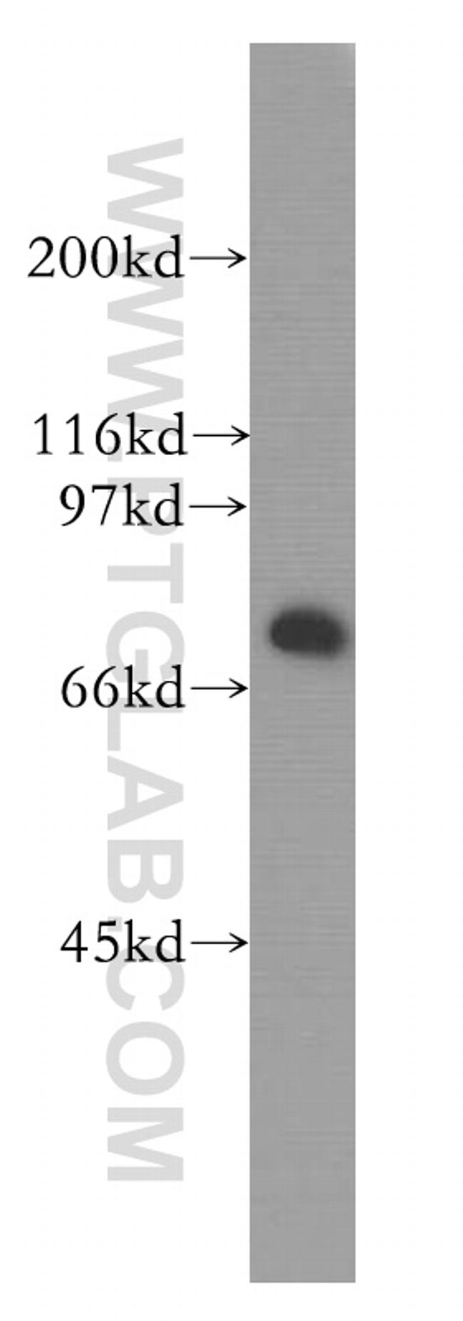 HSPA2 Antibody in Western Blot (WB)