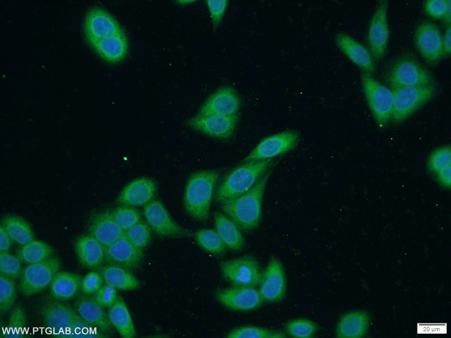 SECISBP2 Antibody in Immunocytochemistry (ICC/IF)