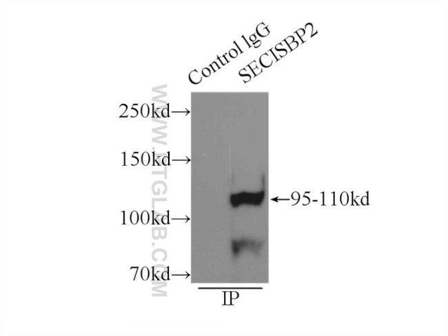 SECISBP2 Antibody in Immunoprecipitation (IP)