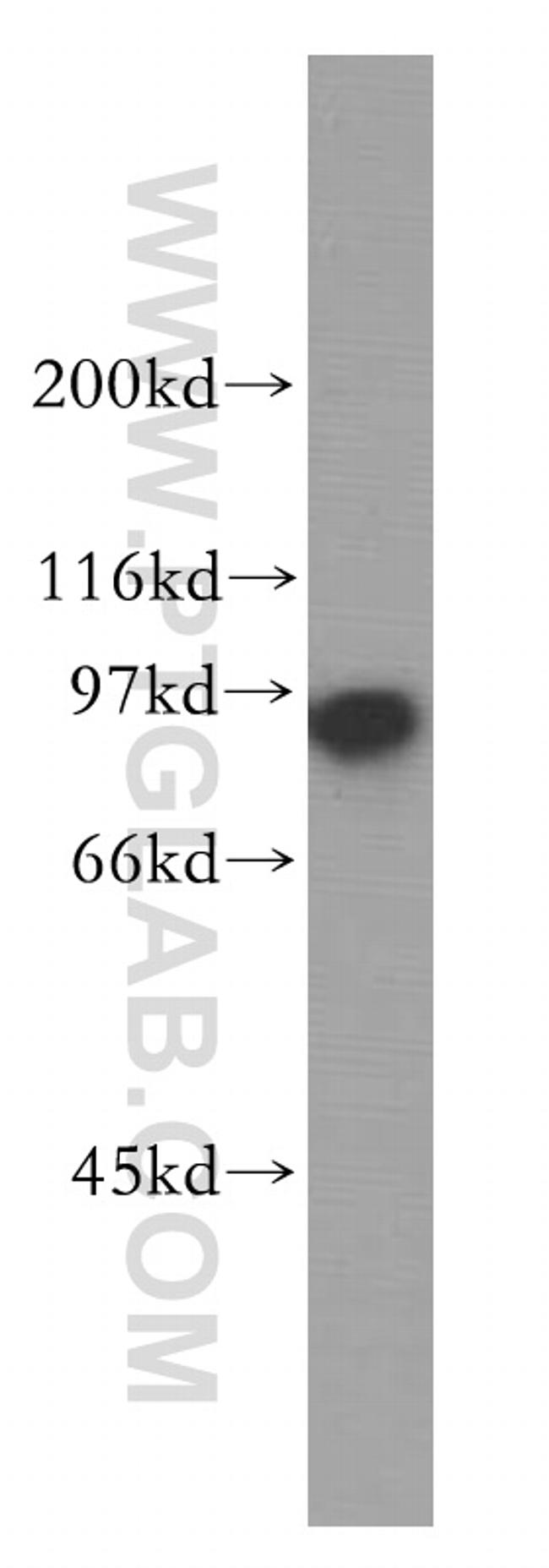 SECISBP2 Antibody in Western Blot (WB)