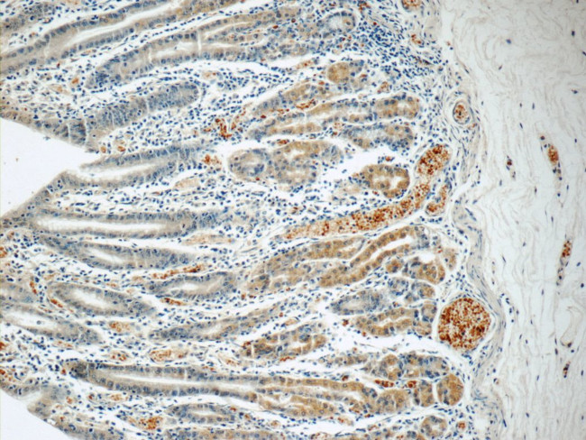 SMAP1 Antibody in Immunohistochemistry (Paraffin) (IHC (P))