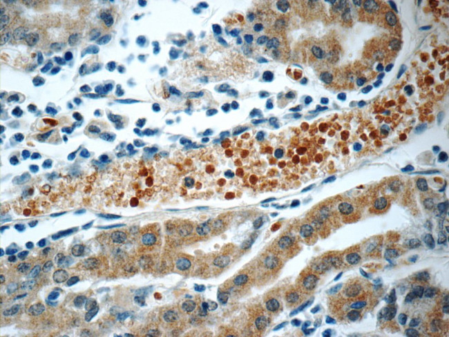 SMAP1 Antibody in Immunohistochemistry (Paraffin) (IHC (P))