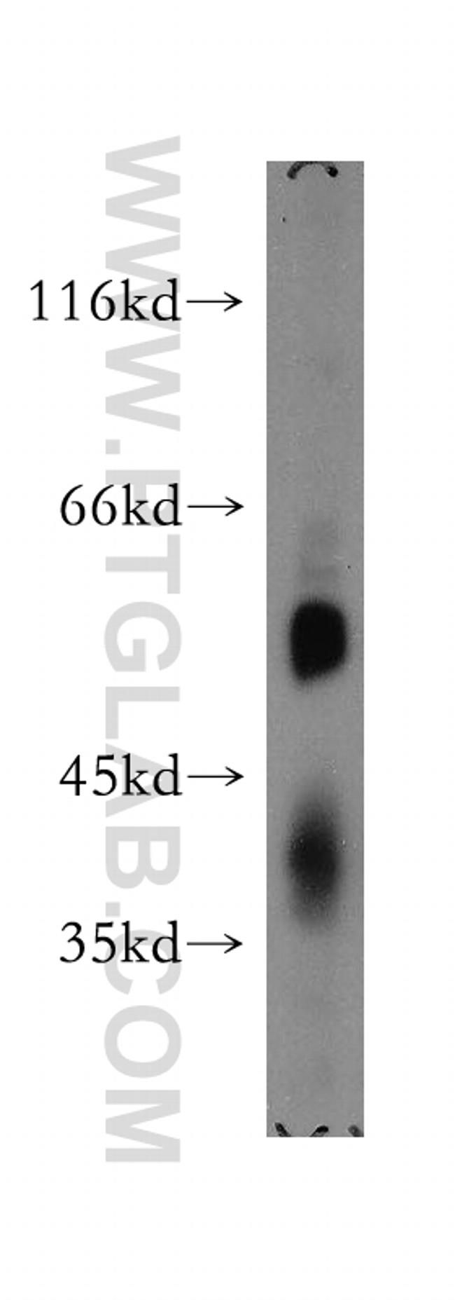 SMAP1 Antibody in Western Blot (WB)