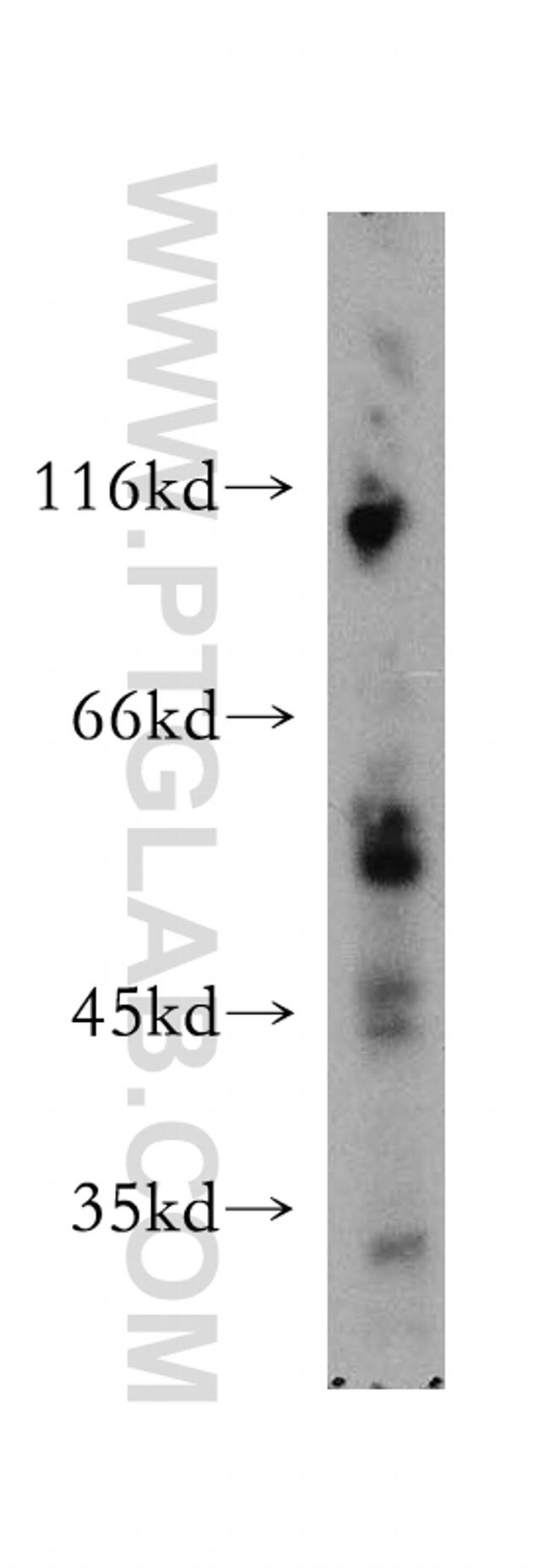 SMAP1 Antibody in Western Blot (WB)