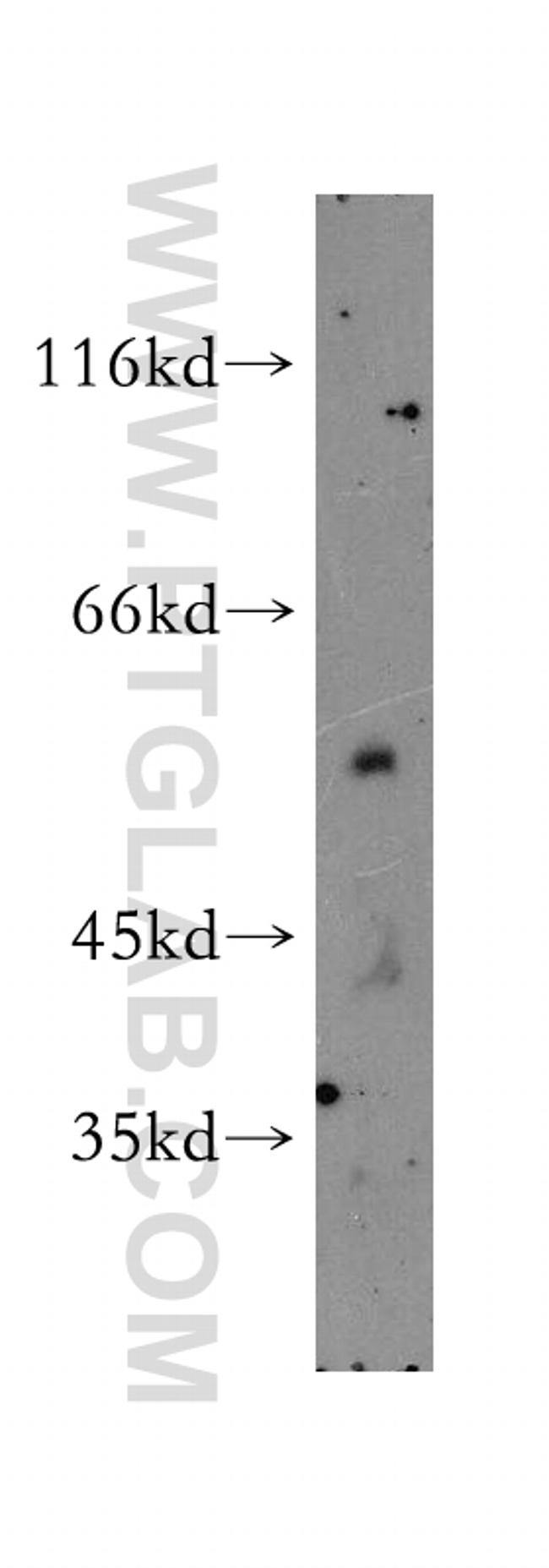 SMAP1 Antibody in Western Blot (WB)