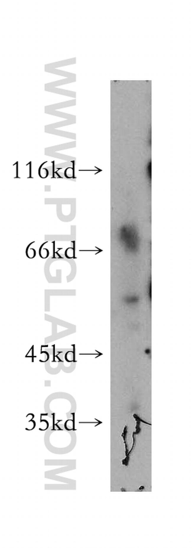 SMAP1 Antibody in Western Blot (WB)