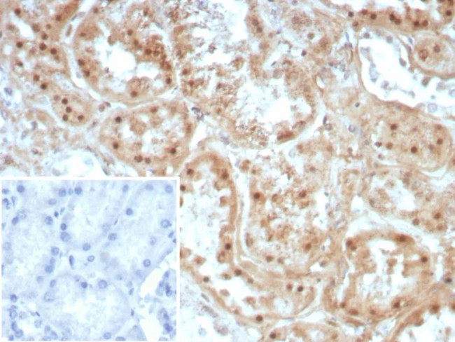 Collagen II (COL2A1) Antibody in Immunohistochemistry (Paraffin) (IHC (P))