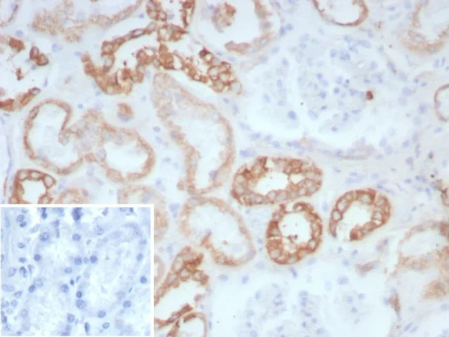 Collagen II (COL2A1) Antibody in Immunohistochemistry (Paraffin) (IHC (P))