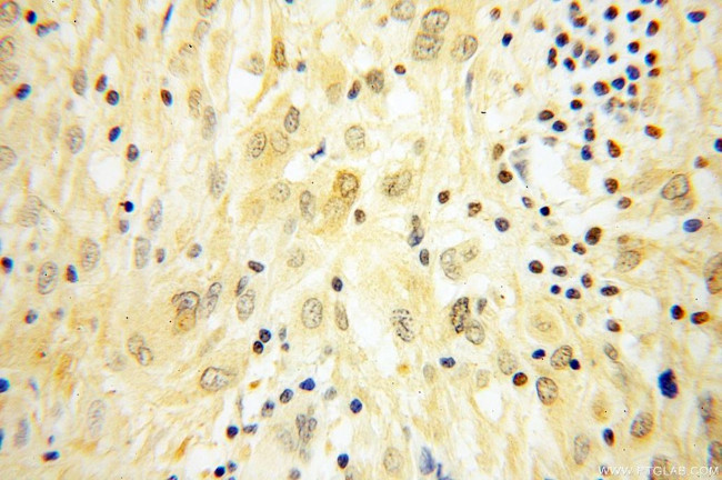 FABP4 Antibody in Immunohistochemistry (Paraffin) (IHC (P))