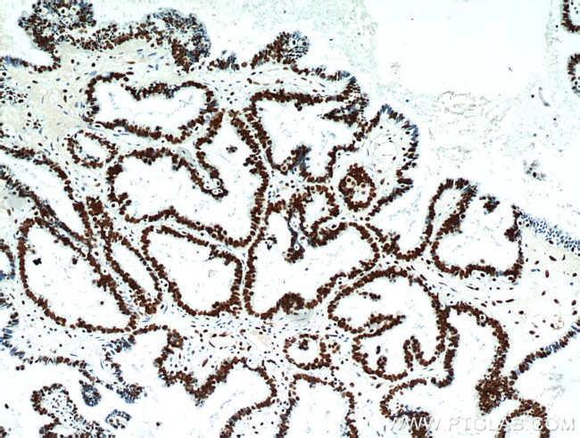 FABP4 Antibody in Immunohistochemistry (Paraffin) (IHC (P))