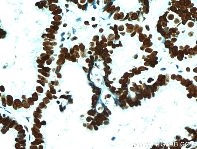 FABP4 Antibody in Immunohistochemistry (Paraffin) (IHC (P))