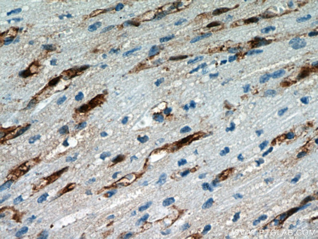 FABP4 Antibody in Immunohistochemistry (Paraffin) (IHC (P))