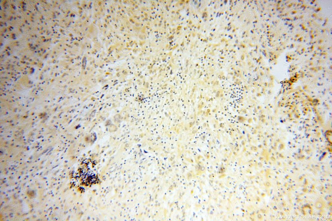 FABP4 Antibody in Immunohistochemistry (Paraffin) (IHC (P))