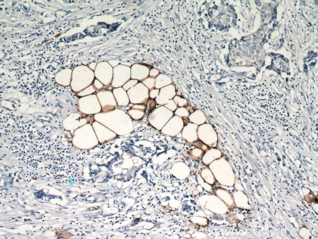 FABP4 Antibody in Immunohistochemistry (Paraffin) (IHC (P))