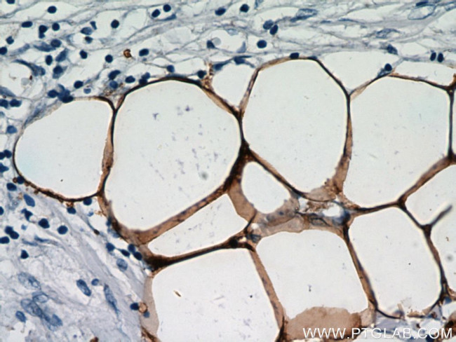 FABP4 Antibody in Immunohistochemistry (Paraffin) (IHC (P))