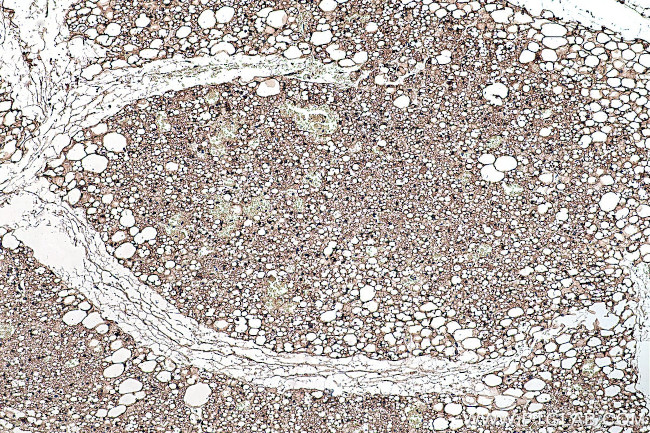 FABP4 Antibody in Immunohistochemistry (Paraffin) (IHC (P))