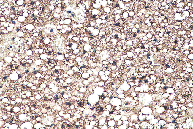 FABP4 Antibody in Immunohistochemistry (Paraffin) (IHC (P))