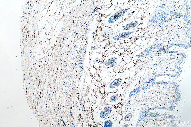 FABP4 Antibody in Immunohistochemistry (Paraffin) (IHC (P))