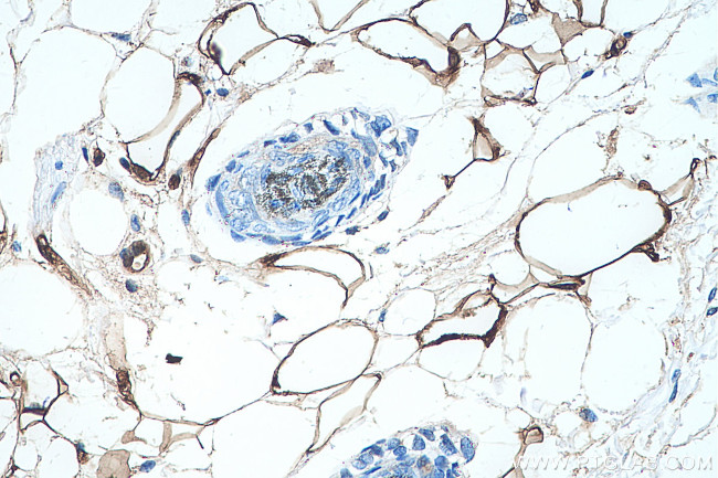 FABP4 Antibody in Immunohistochemistry (Paraffin) (IHC (P))