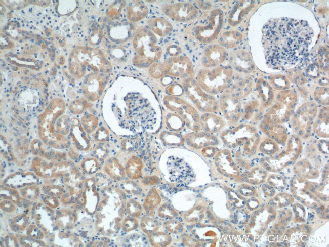 VPS26A Antibody in Immunohistochemistry (Paraffin) (IHC (P))