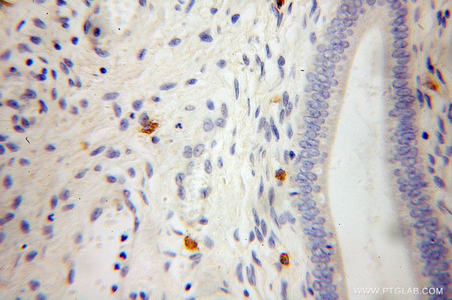 VPS26A Antibody in Immunohistochemistry (Paraffin) (IHC (P))