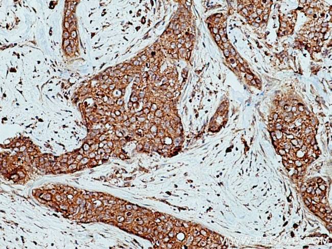 VPS26A Antibody in Immunohistochemistry (Paraffin) (IHC (P))