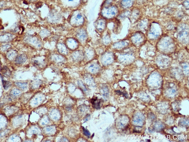 VPS26A Antibody in Immunohistochemistry (Paraffin) (IHC (P))