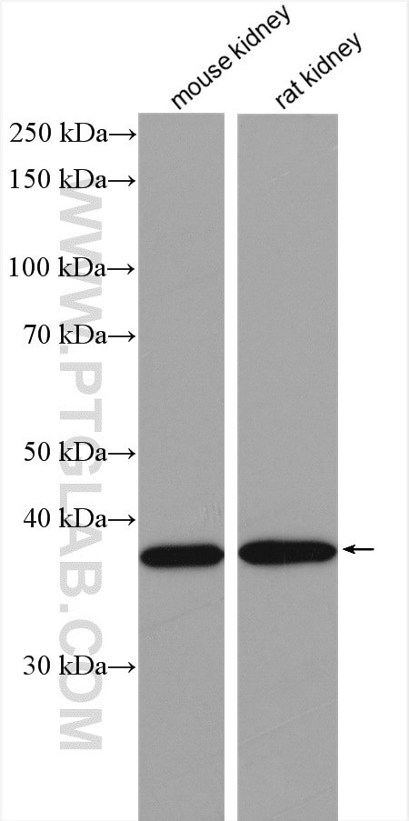 VPS26A Antibody in Western Blot (WB)