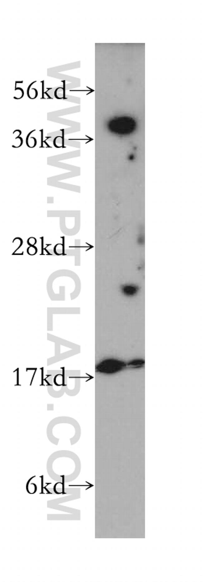 VPS26A Antibody in Western Blot (WB)