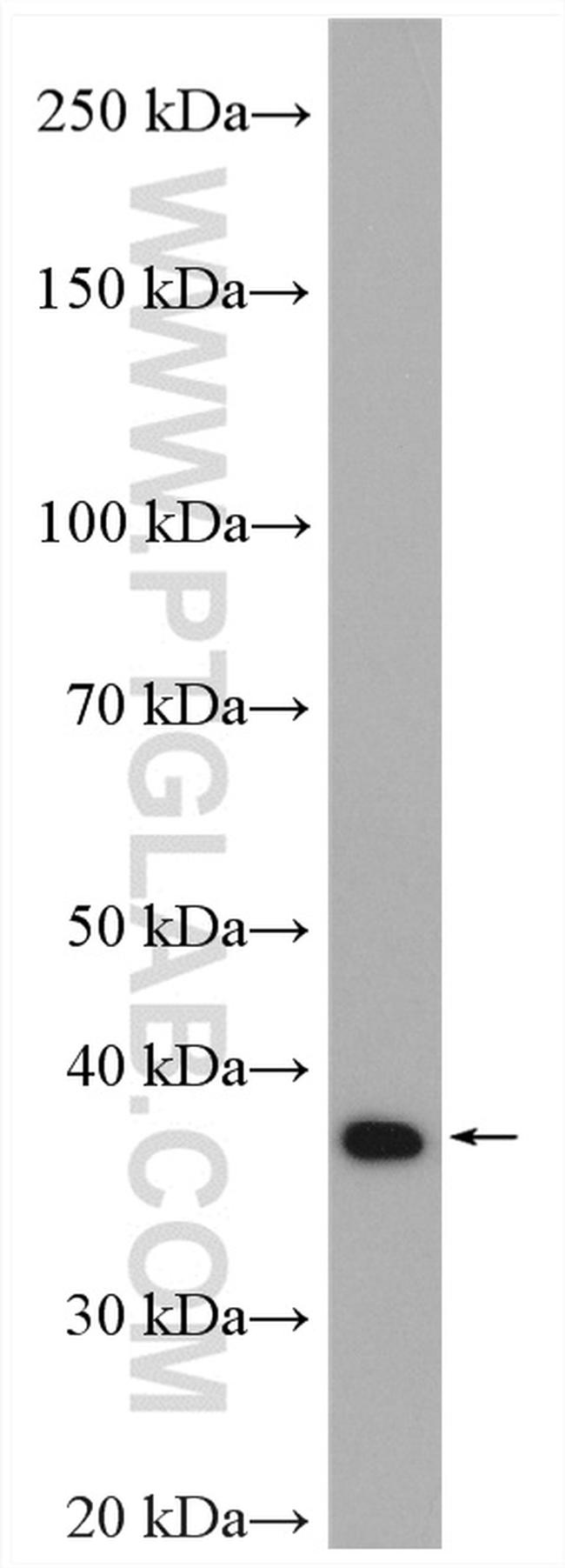 VPS26A Antibody in Western Blot (WB)