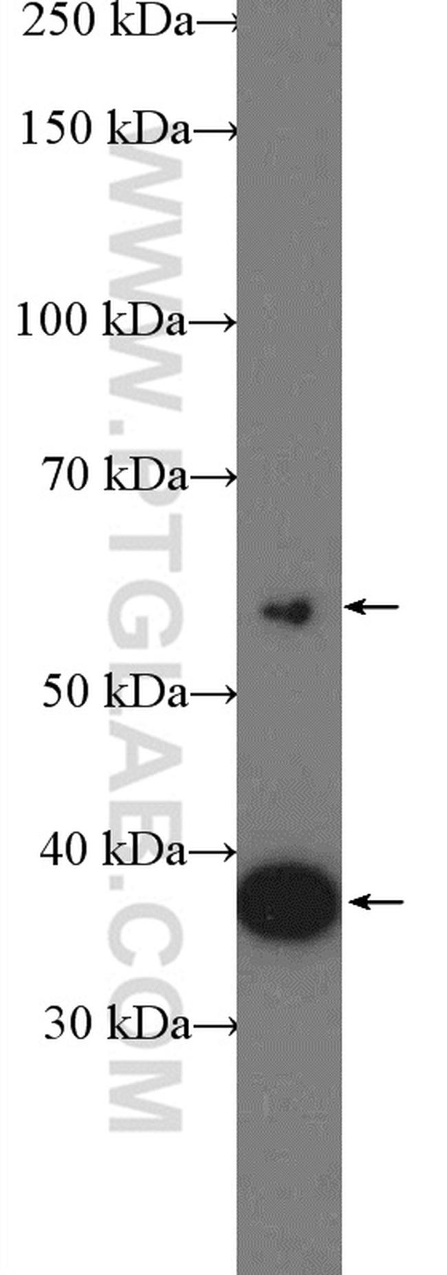 VPS26A Antibody in Western Blot (WB)