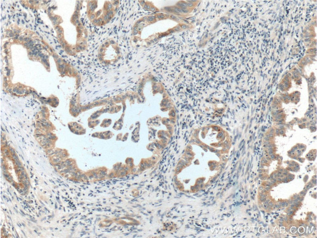 BACE1 Antibody in Immunohistochemistry (Paraffin) (IHC (P))