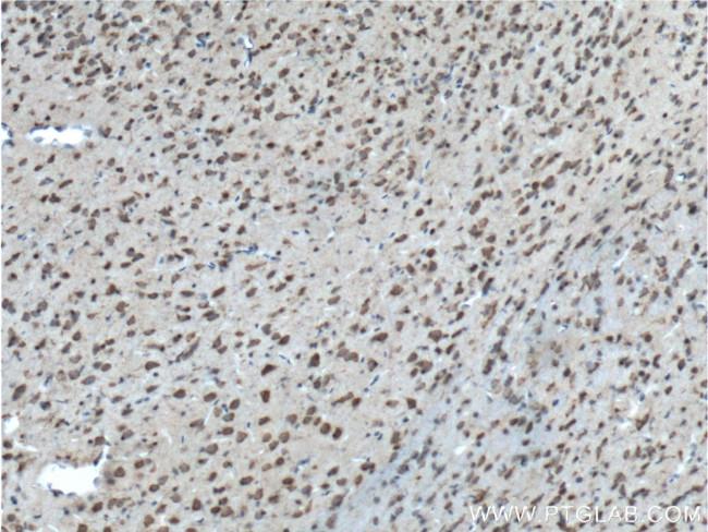 BACE1 Antibody in Immunohistochemistry (Paraffin) (IHC (P))