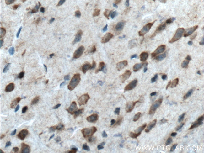 BACE1 Antibody in Immunohistochemistry (Paraffin) (IHC (P))