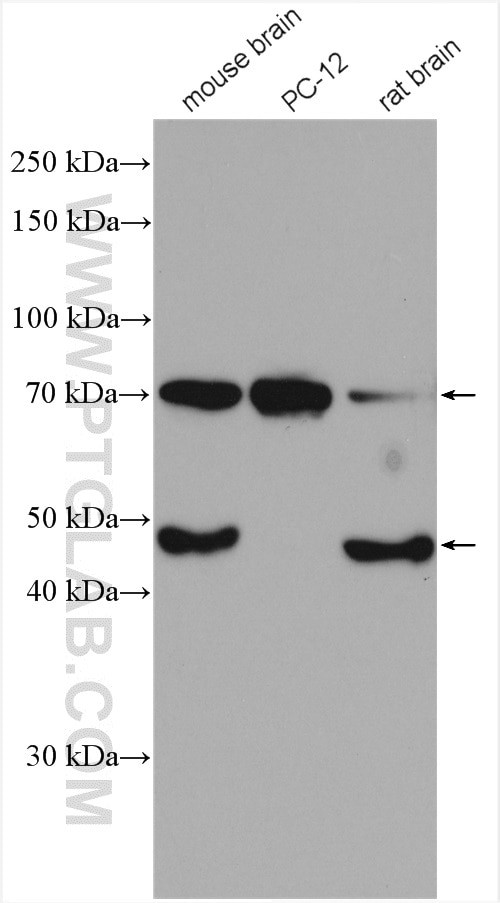 BACE1 Antibody in Western Blot (WB)