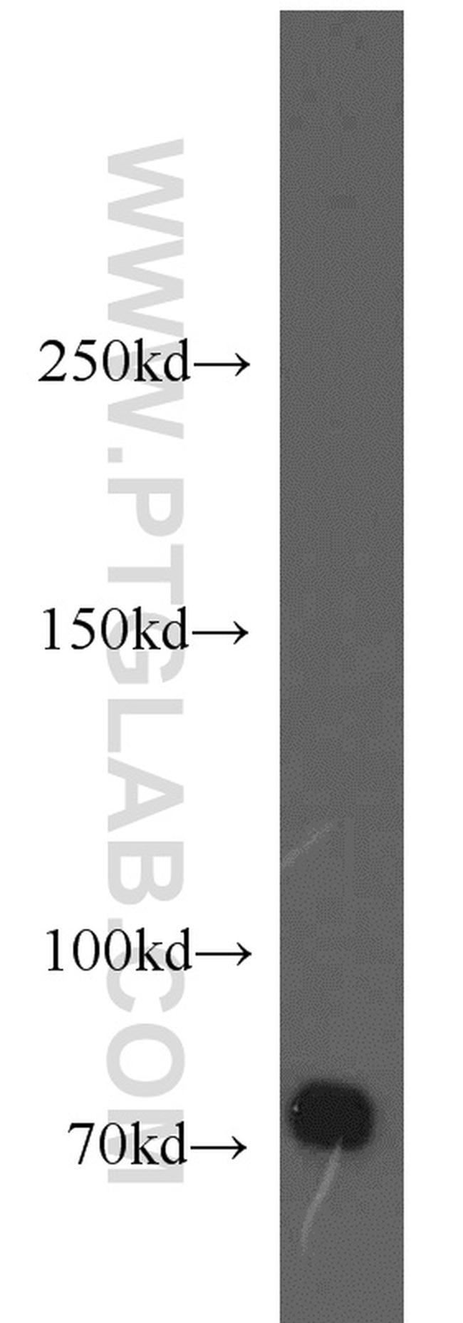 BACE1 Antibody in Western Blot (WB)