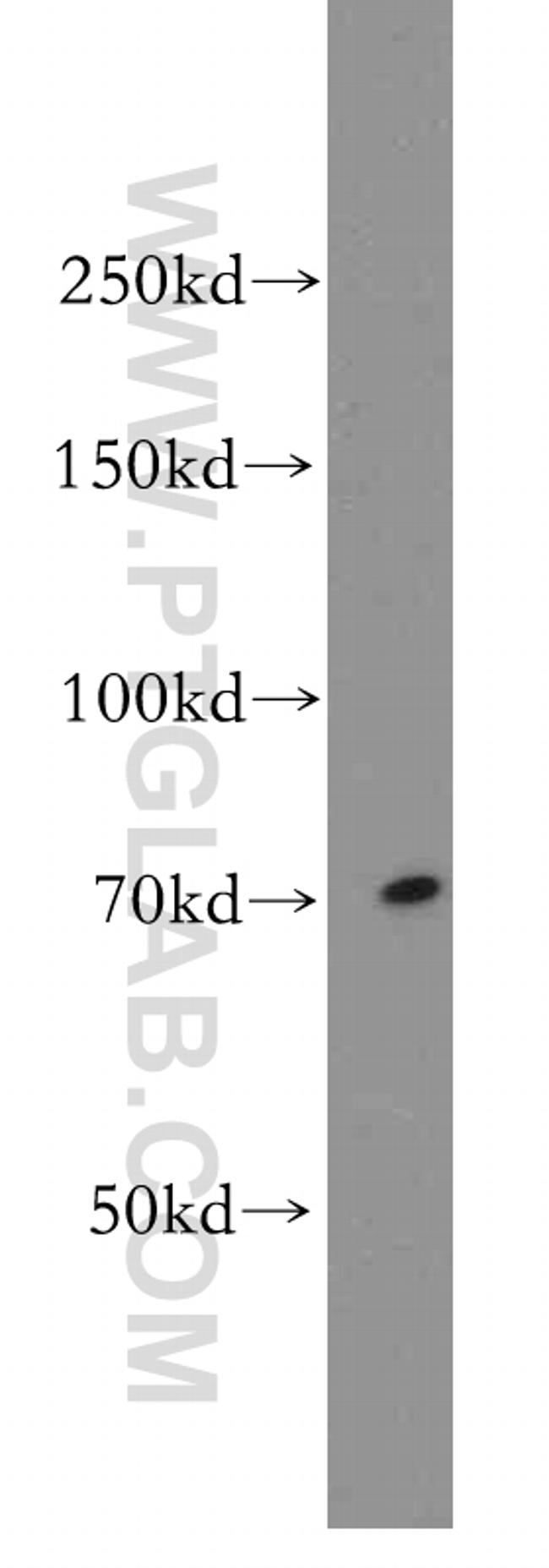 BACE1 Antibody in Western Blot (WB)