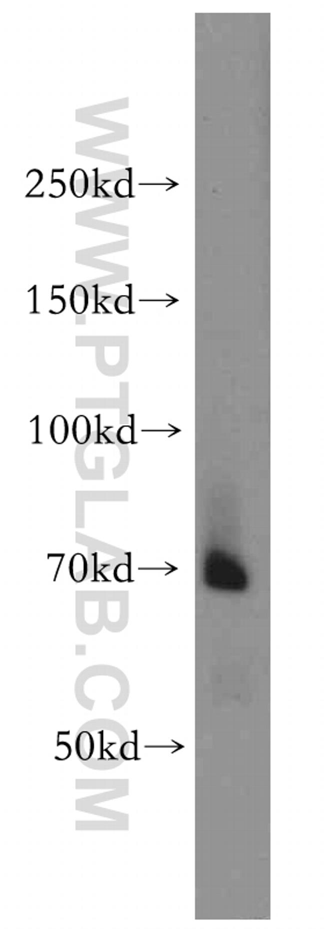 BACE1 Antibody in Western Blot (WB)