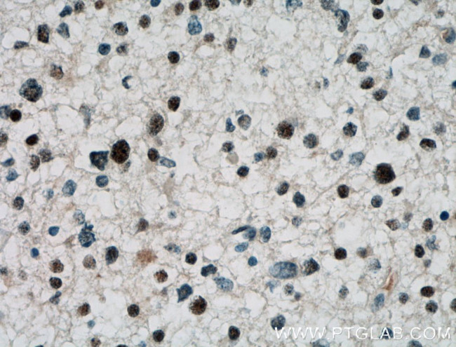 ARNT2 Antibody in Immunohistochemistry (Paraffin) (IHC (P))