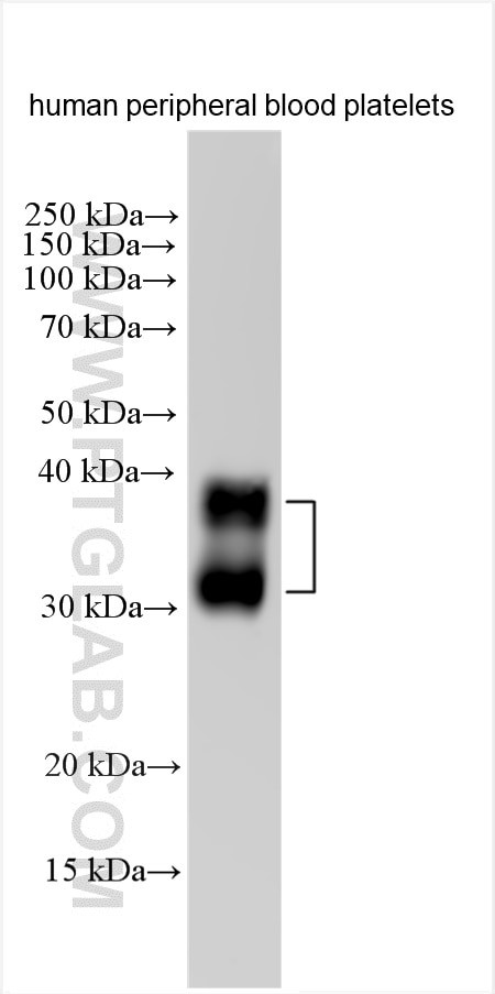 CLEC2/CLEC1B Antibody in Western Blot (WB)