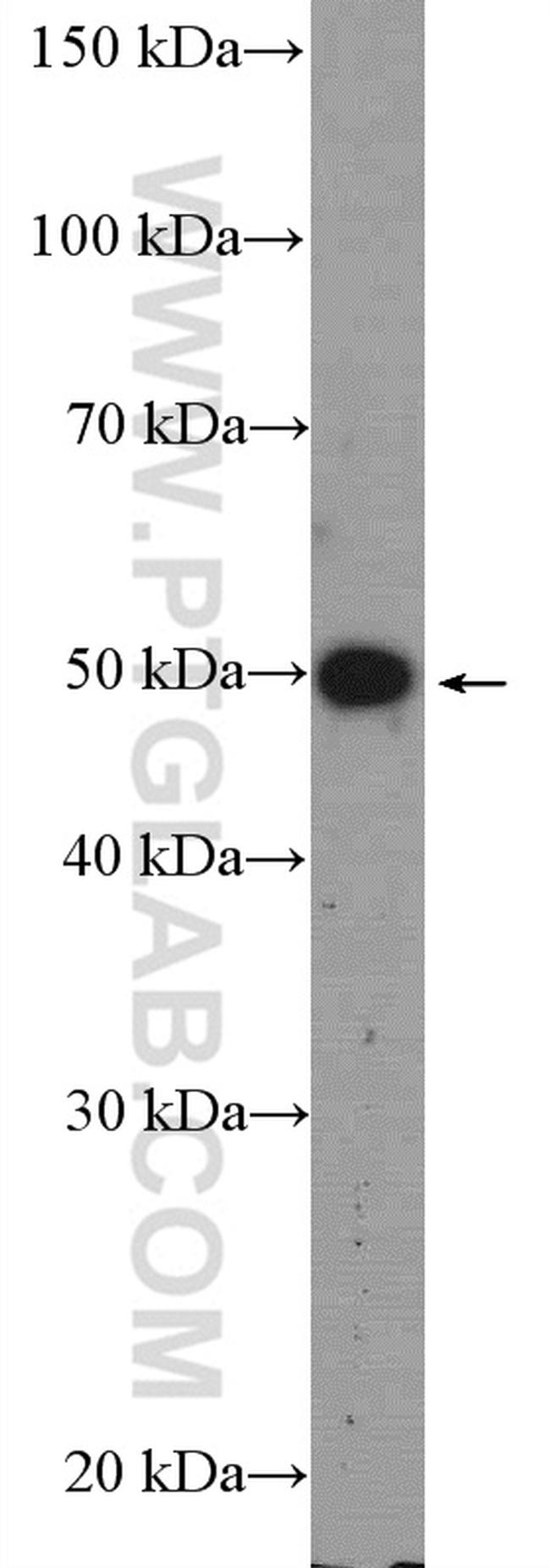 LRAT Antibody in Western Blot (WB)