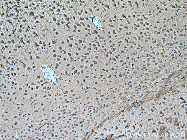 ITPKB Antibody in Immunohistochemistry (Paraffin) (IHC (P))