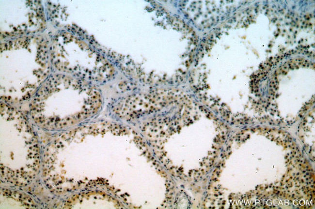 TAF1B Antibody in Immunohistochemistry (Paraffin) (IHC (P))