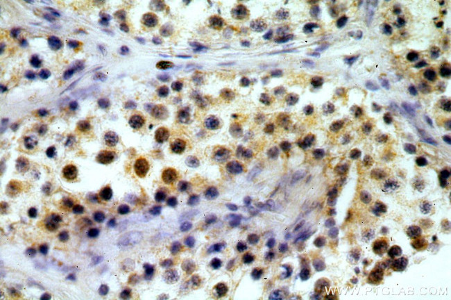 TAF1B Antibody in Immunohistochemistry (Paraffin) (IHC (P))