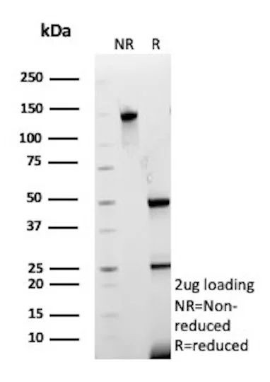 Collagen IV (COL4A1/COL4A2) Antibody in SDS-PAGE (SDS-PAGE)