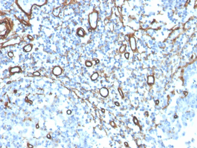 Collagen IV Antibody in Immunohistochemistry (Paraffin) (IHC (P))