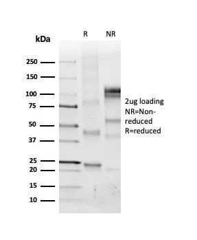 Collagen IV Antibody in SDS-PAGE (SDS-PAGE)