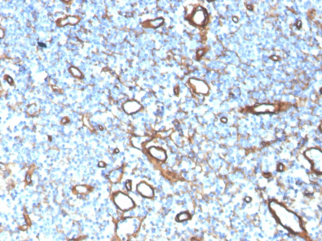 Collagen IV Antibody in Immunohistochemistry (Paraffin) (IHC (P))